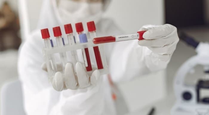 Prueba de coronavirus en laboratorios privados cuesta cerca de G. 800 mil