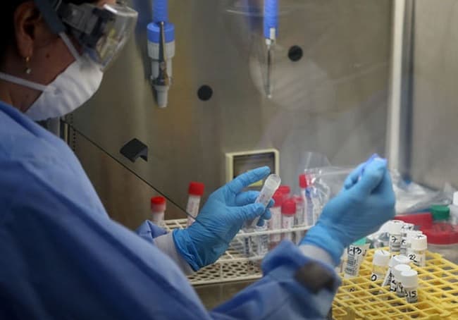 Hematólogo alerta sobre síntomas no conocidos de coronavirus