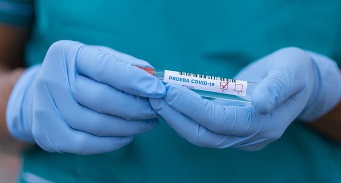 Central y Alto Paraná aumentan cifras de pacientes de Covid-19