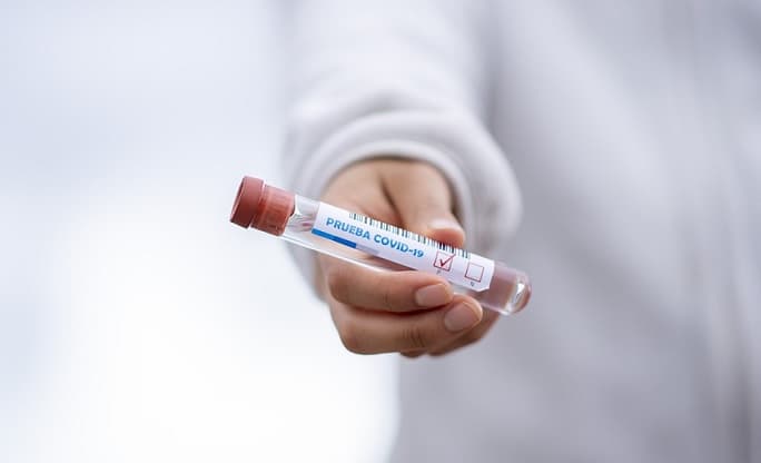 APF confirma casos positivos en Olimpia y Libertad