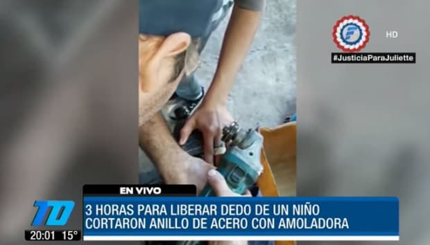 Con amoladora sacan anillo de acero de la mano de un niño
