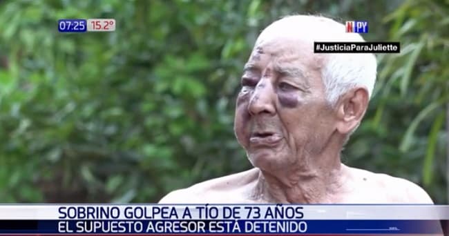 Hombre de 73 años denuncia a su sobrino tras recibir golpiza
