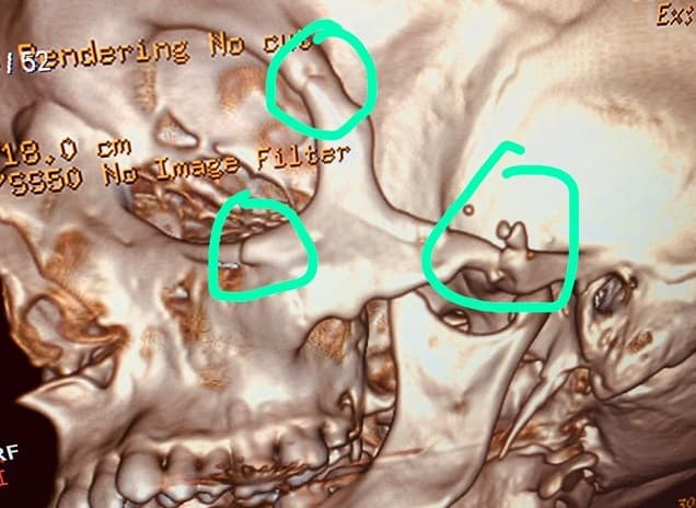 Veterinario busca a hombre que le “rompió la cara” con una piedra