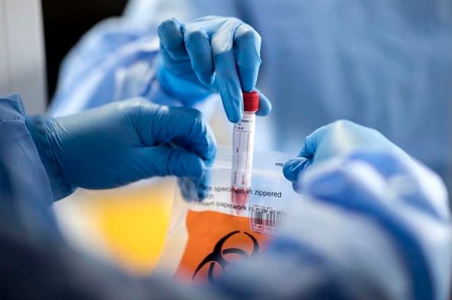 Jóvenes contagian a mayores y eso acaba en muertes, según infectólogo