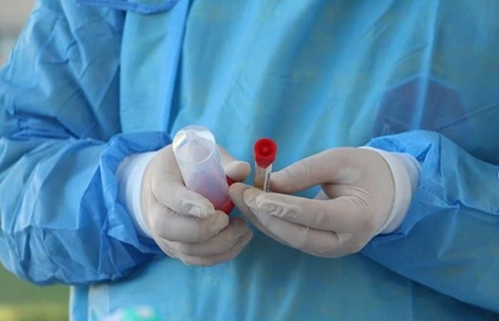 Confirman casos positivos entre árbitros