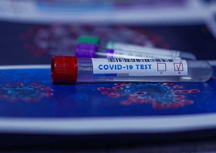 Demanda de test de Covid-19 supera la capacidad de Salud, confirman Sequera