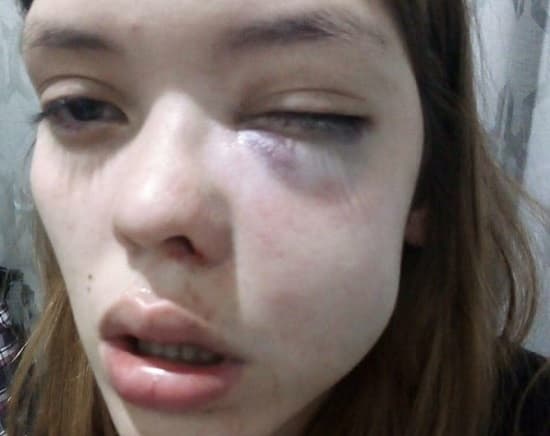 Denuncian golpiza sufrida por mujer y apuntan a expareja