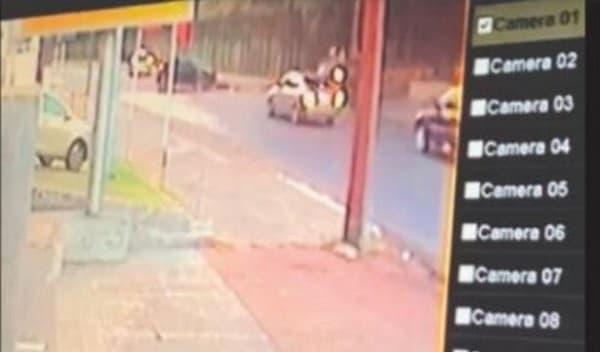 Accidente en Uber: Implantarán prótesis craneal a joven