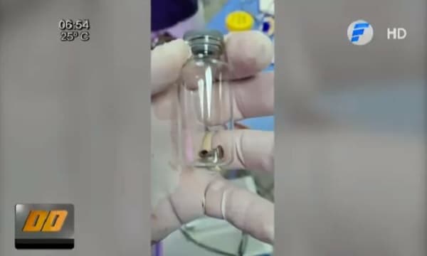 Operan a niño para extraerle el eje de un cortaúñas