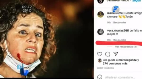 Policía lanza despreciable mensaje hacia ciudadana herida  