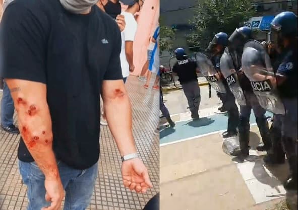 Violenta represión en protesta contra retroceso de fase en Formosa