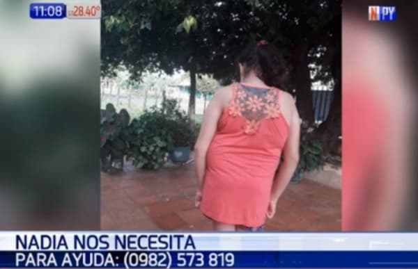 Adolescente de 13 años necesita G. 50 millones para someterse a cirugía