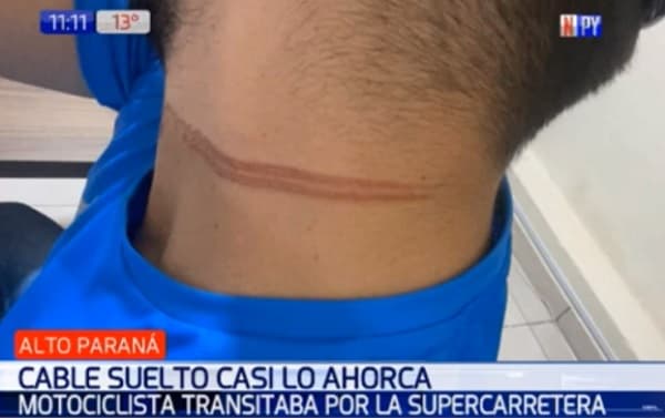 Motociclista casi es ahorcado por cable suelto en Alto Paraná