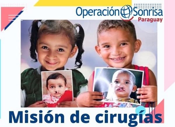 “Operación sonrisa” inicia nueva campaña de cirugías gratuitas