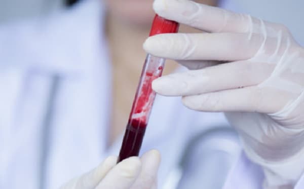 Profesionales concientizan sobre la leucemia y enfermedades de la sangre