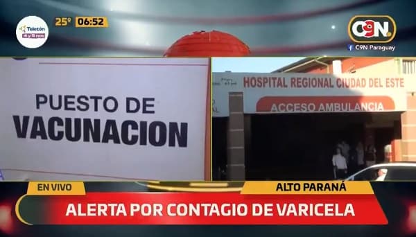Alerta por contagio de varicela en Alto Paraná