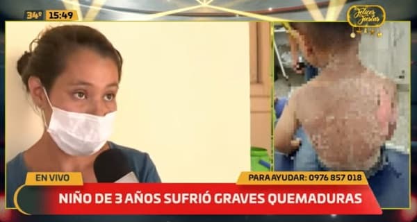 Niño de tres años sufre graves quemaduras por derramamiento de agua caliente