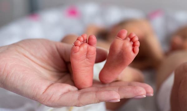 Caso Siameses: Segundo bebé fallece a casi un mes de cirugía