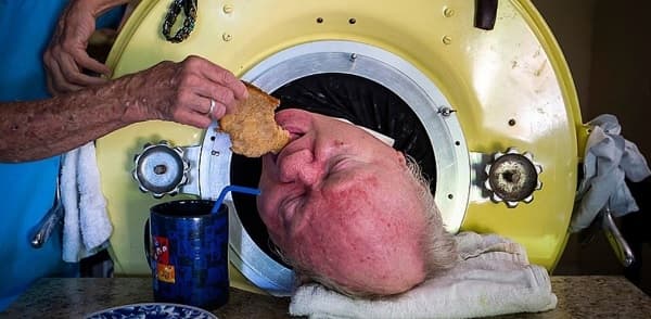 Falleció Paul Alexander, quien vivió 70 años con un pulmón de acero