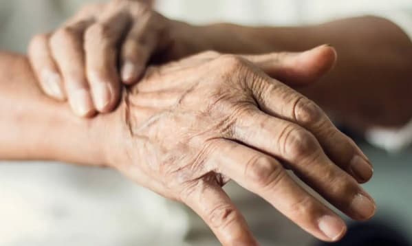 Diagnóstico precoz mejora calidad de vida en pacientes con Parkinson