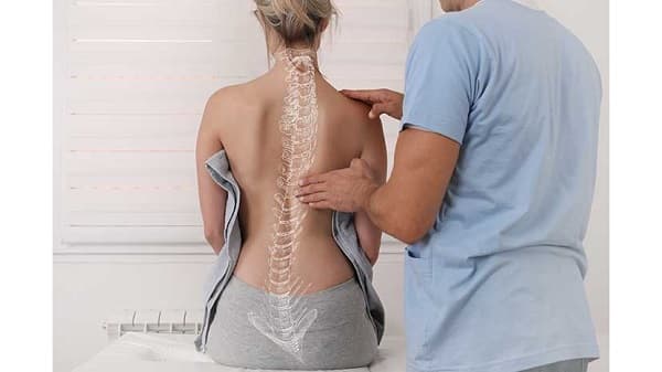 Escoliosis afecta predominantemente a mujeres adolescentes