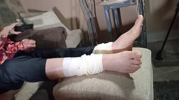 Atropellada por Lince tras marcha Gen Z relata el hecho