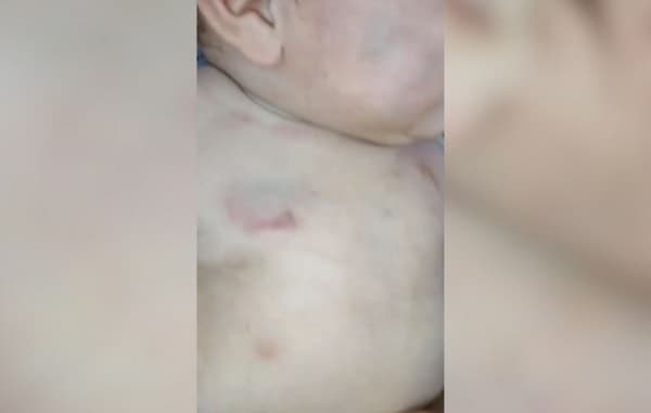 Bebé internado tras presunta agresión en Minga Guazú