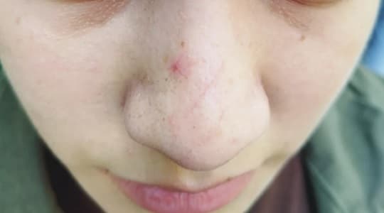 Embarazada denuncia agresión y despido de una chipería