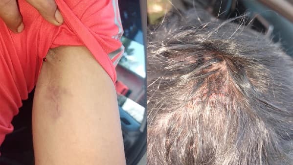 Denuncian a concejal por agresión a persona con discapacidad